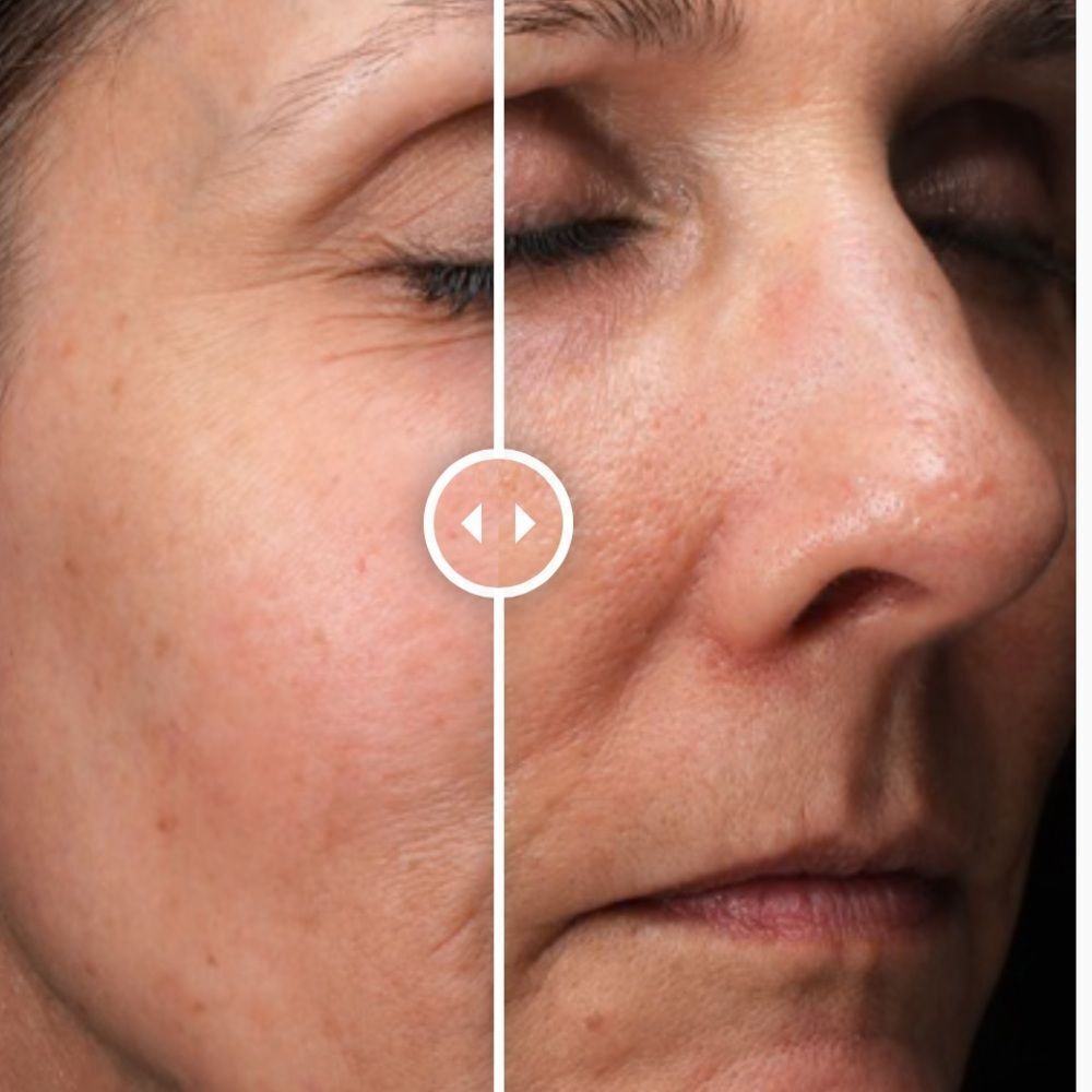 Alastin C Radical Defense Antioxidant Serum for redness, uneven texture & lines - Picture 7 of 7